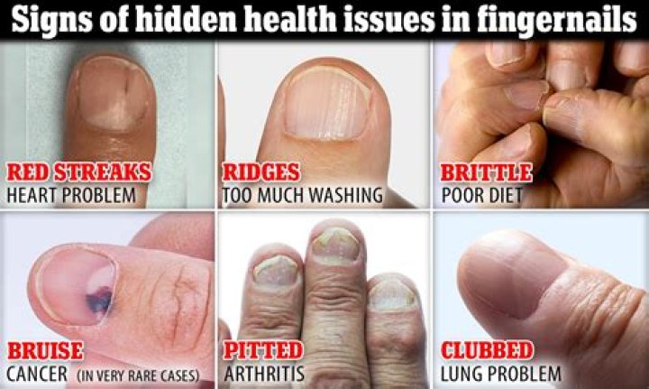 Why are my fingernails reddish purple?