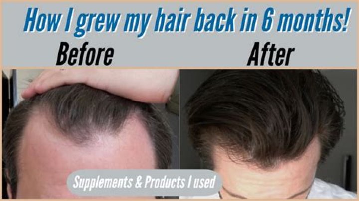Will my hair grow back after being ripped from the scalp?